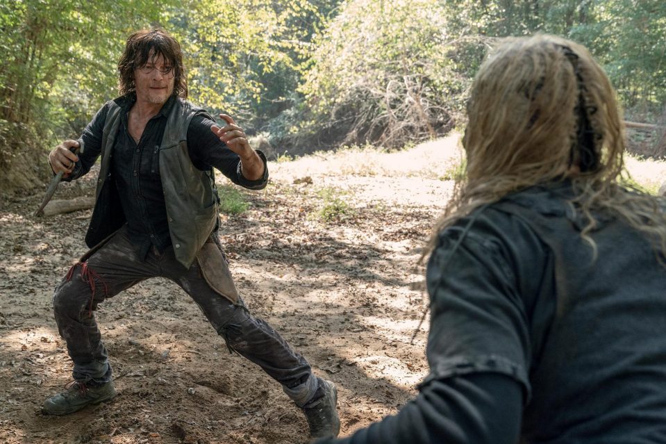  Norman Reedus sustained injuries on set