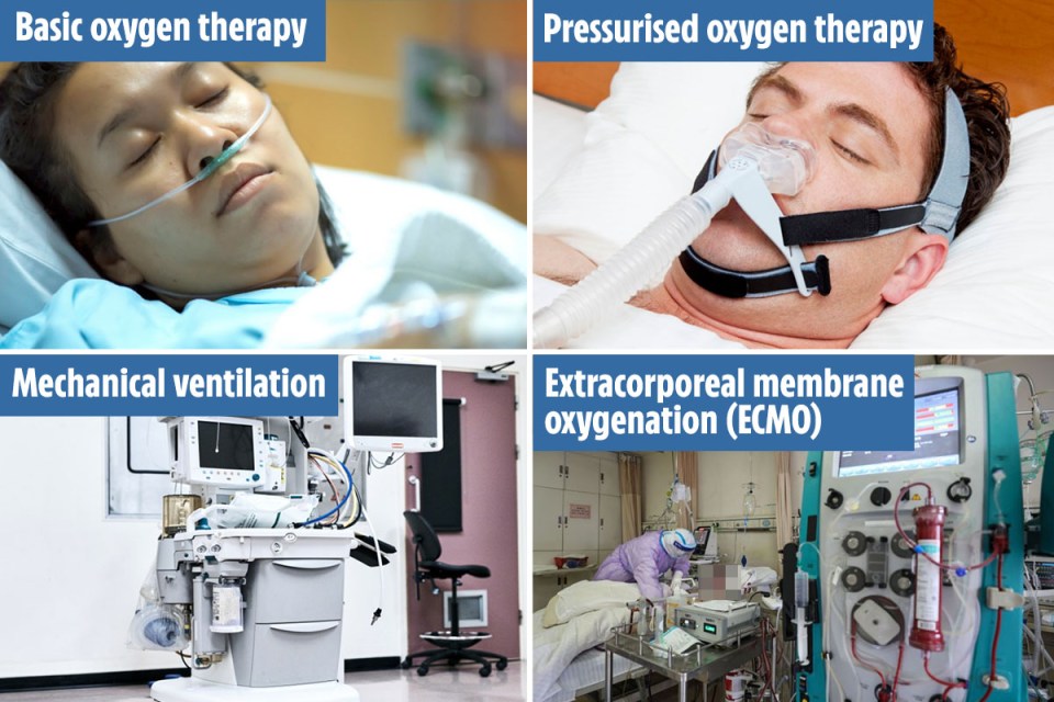 There are four stages of coronavirus treatment in ICU