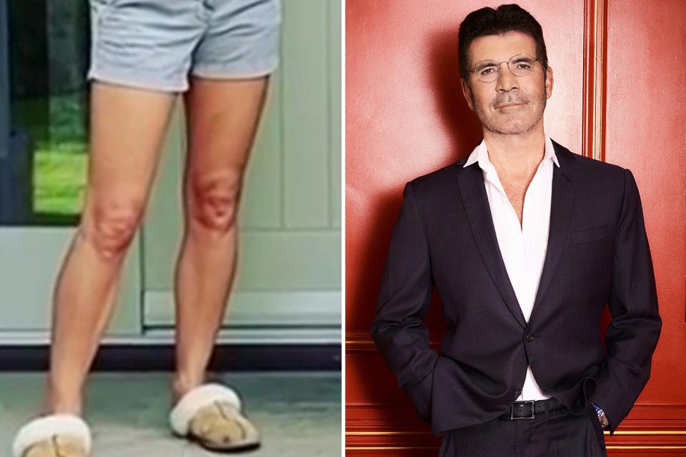  Can you spot BGT co-star Simon Cowell on Amanda's knee?