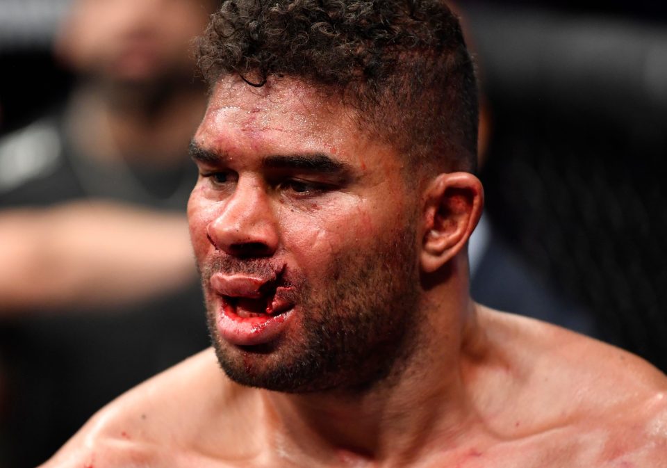  Alistair Overeem almost split his whole face open when Jairzinho Rozenstruik connected with his lip in 2019