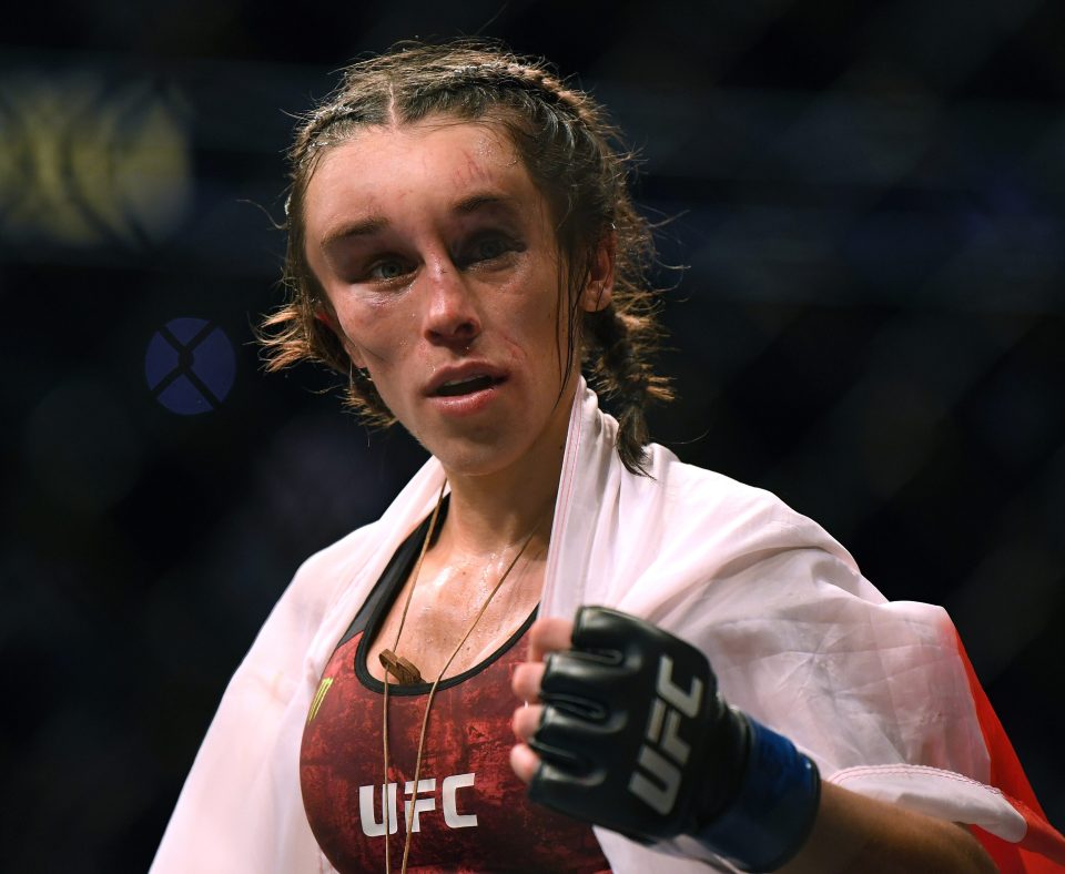  Joanna Jedrzejczyk's head swelled up at the end of her fight against Weili Zhang earlier this year