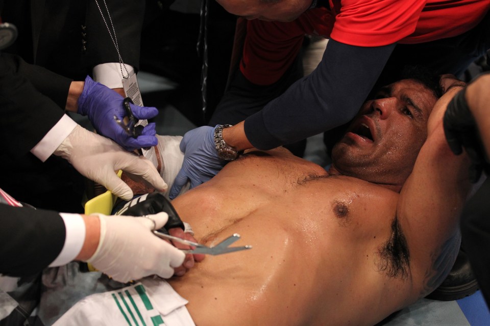  Antonio Rodrigo Nogueira had his shoulder popped out by Frank Mir in 2011