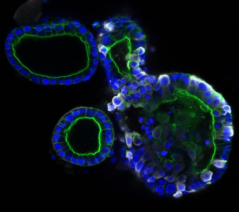  Researchers have found that the coronavirus SARS-CoV-2 can infect cells of the intestine and multiply there