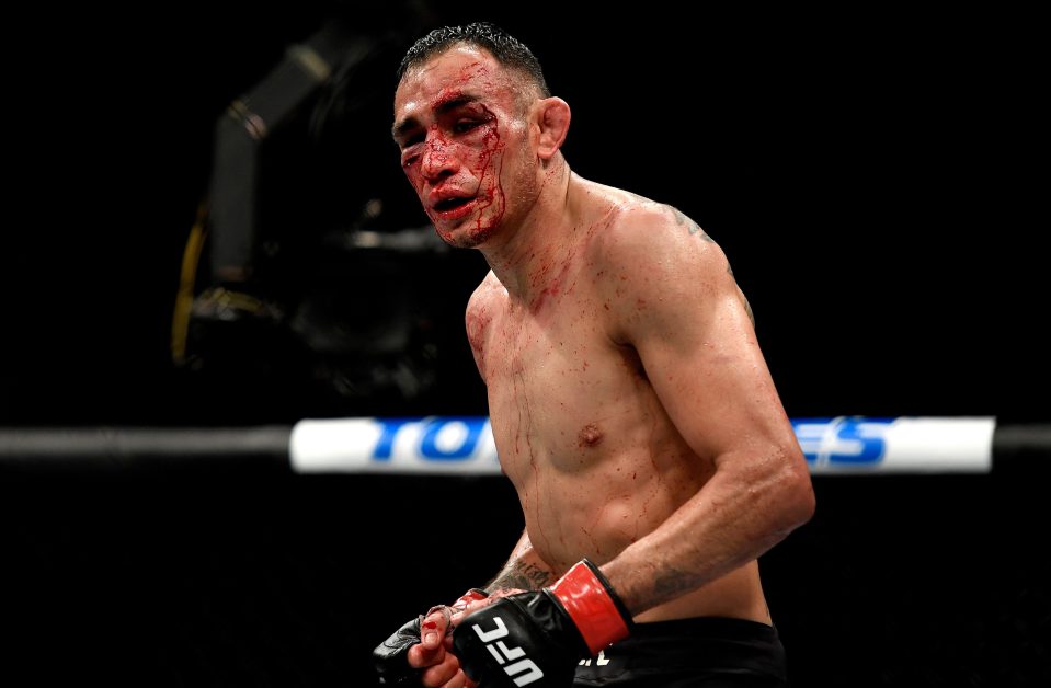  Tony Ferguson has been banned from fighting for at least 60 days