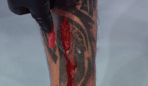  Commentator Daniel Cormier compared his gash to a bullet hole