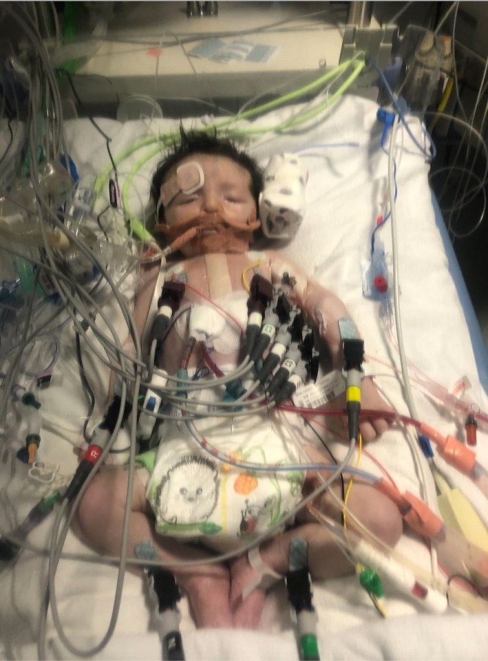 Thomas was fully ventilated for six days as he was unable to breath