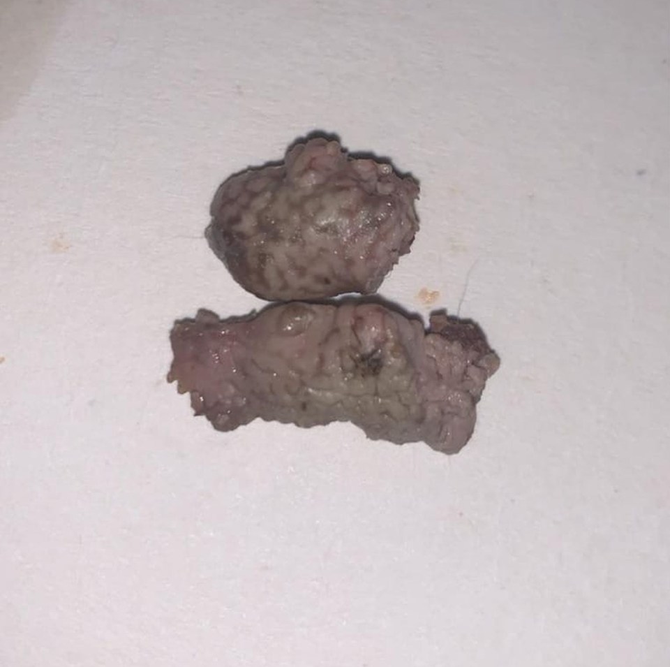 Rogue “parts of a brain or kidney” found in a KFC chicken bucket