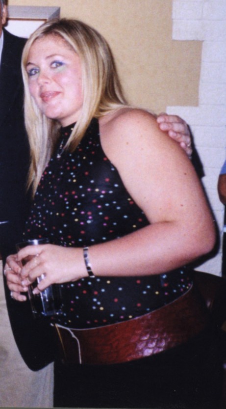 Suzi in 2001 before losing weight