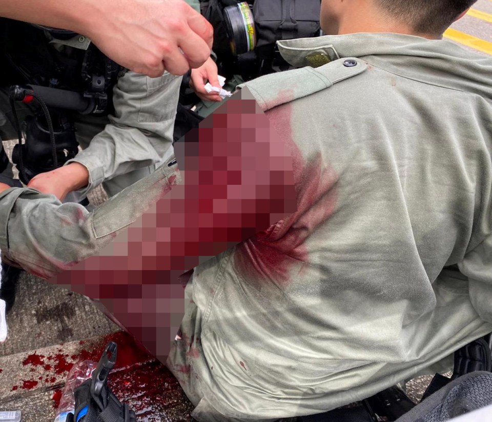 The cop was pictured with blood completely soaking his shirt