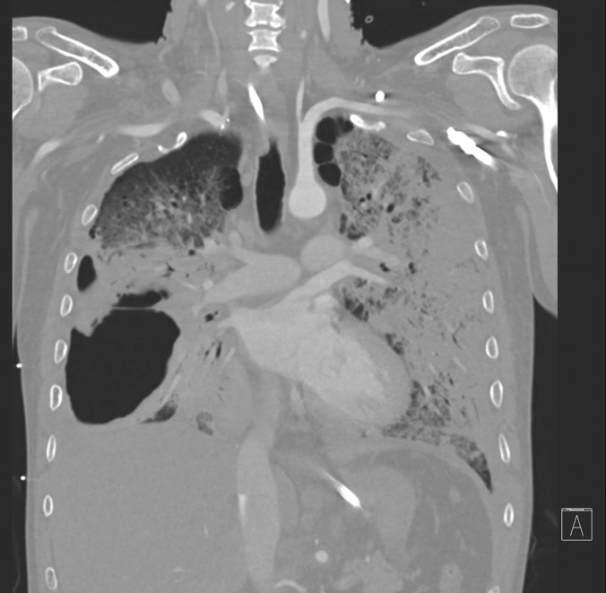 The scan image above is of a 40-year-old man who was otherwise fit and healthy 