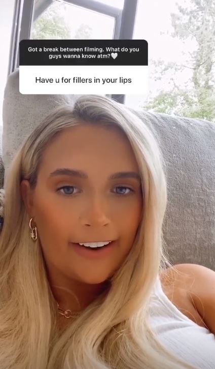 The reality star hilariously showed fans what she might look like without fillers