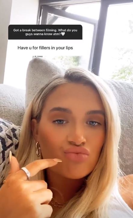 Love Island's Molly-Mae Hague has opened up on how she regrets her fillers but is too scared to take them out