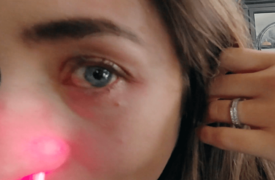 The 30-year-old showed fans her bloodshot eyes as the family got pet rabbits