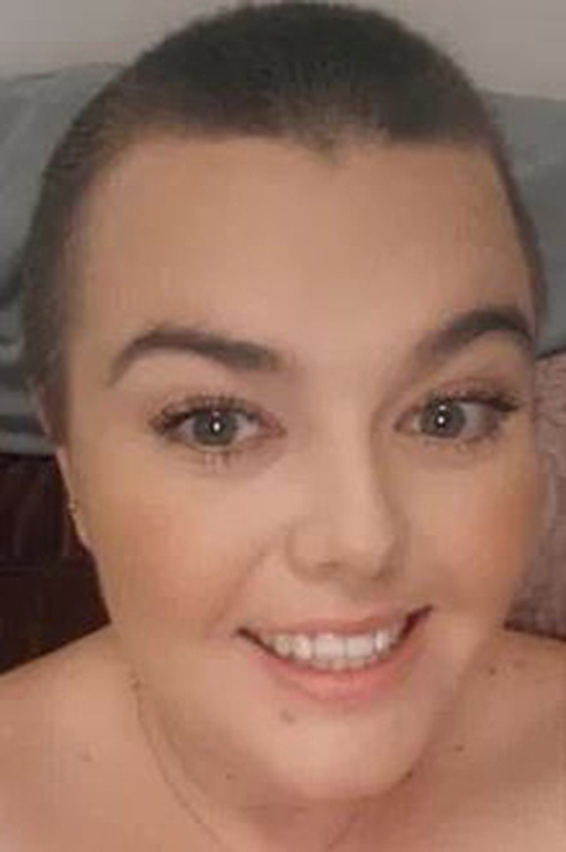 Grace said her hair loss was so bad after the virus that she was forced to shave her head