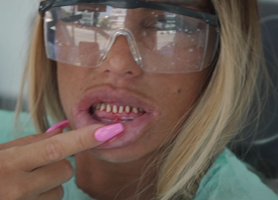 Jodie Marsh slammed Katie's natural teeth by posting laughing emoji's below a post calling Katie 'trash'