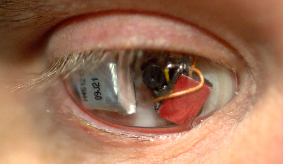 Tech implants, like this ‘Eyeborg’ camera developed by filmmaker Rob Spence, are current biohacks