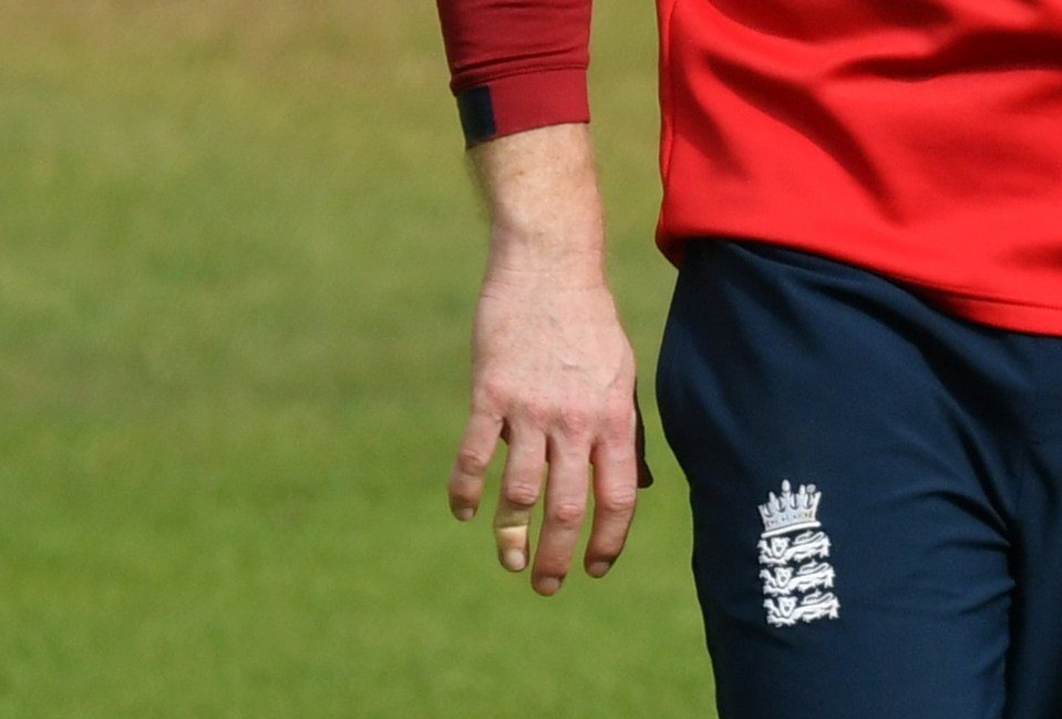 England captain Morgan's finger was bent horribly out of shape