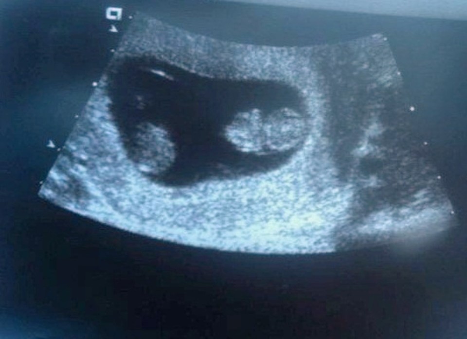 A scan of one of his children