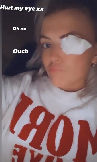 Lucy Fallon revealed she had injured her eye as she posed with a bandage