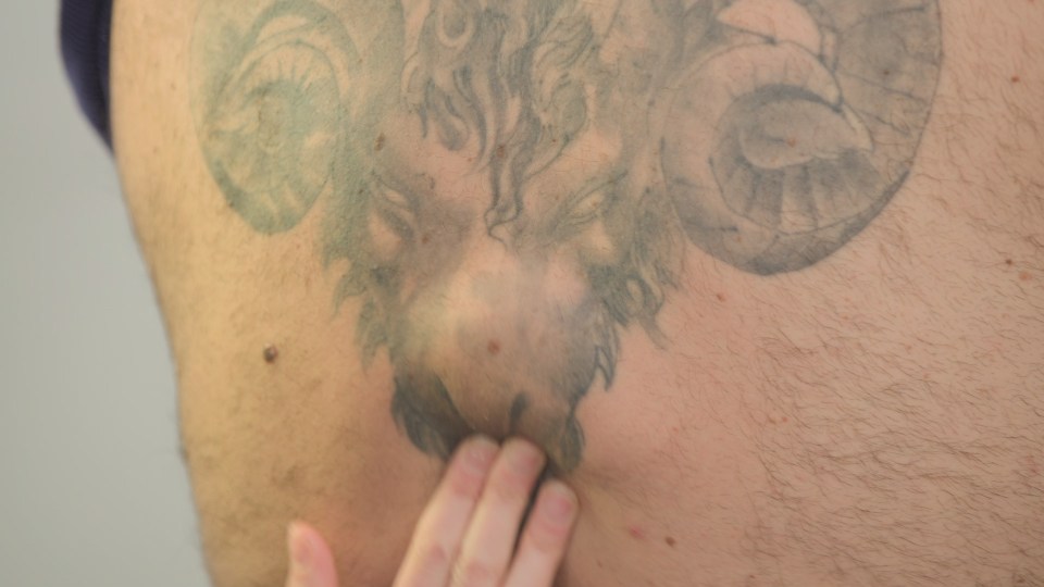 Ali had a lump growing in his back - right under his ram-shaped tattoo