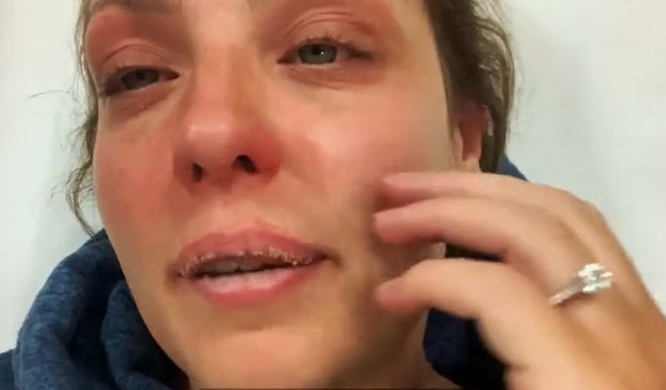 She let the cameras in to show the harsh reality of battling a disease such as Crohn’s