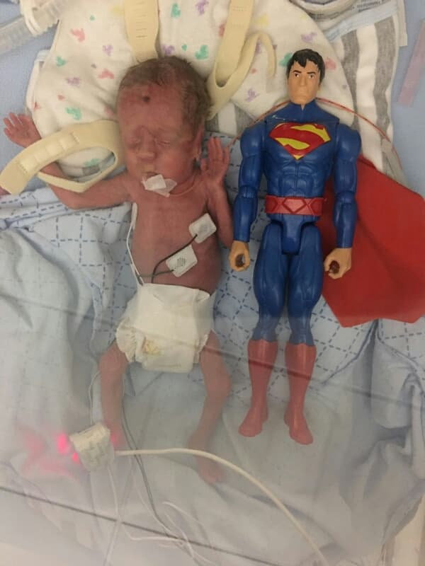 Premature Logan Ray was the size of a Superman figure at 4 weeks and 2 days old