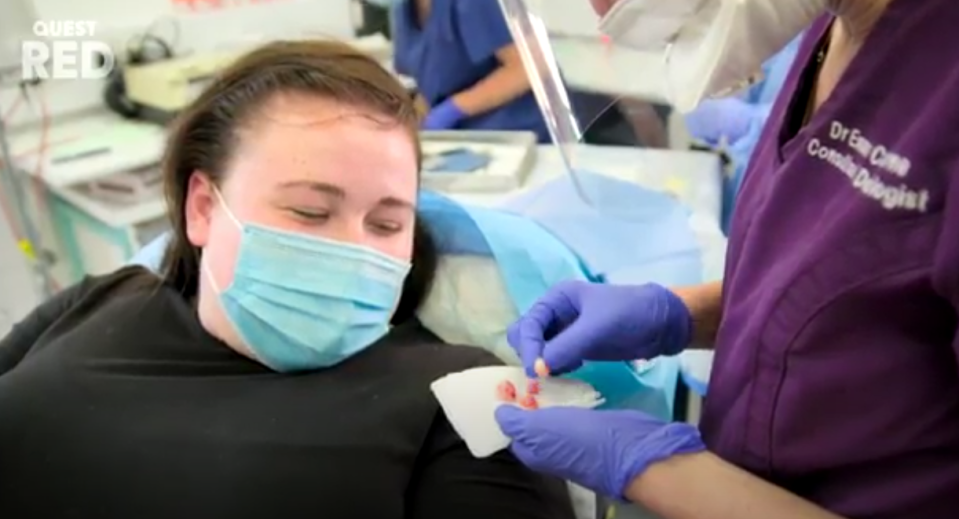 Dr Emma shows Chloe the cysts that had been growing in her scalp but she was pretty disgusted to see them