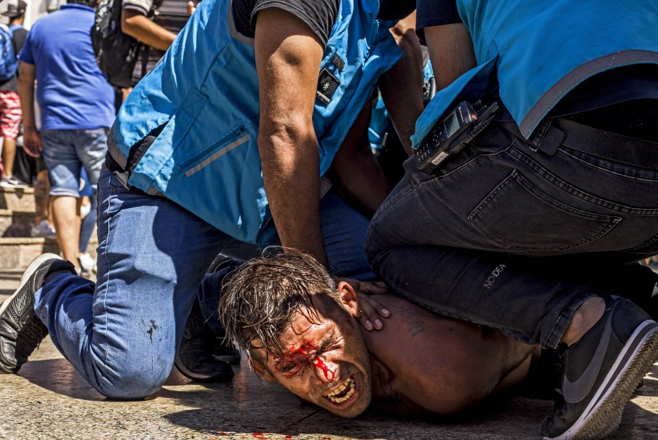 A man seen with blood on his face after riots erupted amongst the mourners