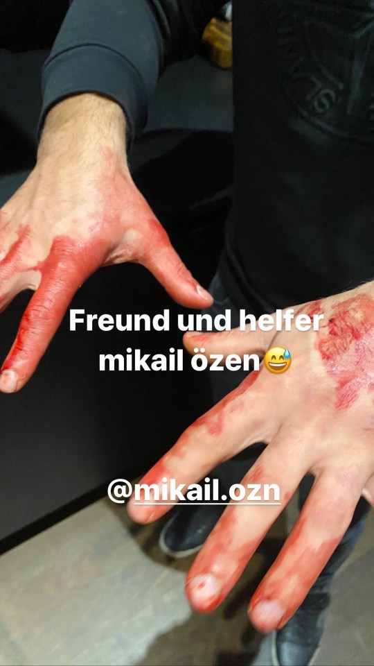 Recep shared this image of his pal’s bloody hands with the caption “Friend and helper”