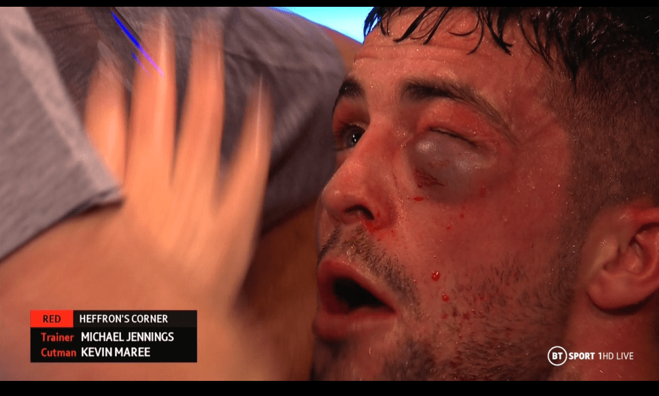 Mark Heffron's eye was swollen completely shut with the referee waving off the fight at the end of the fourth round