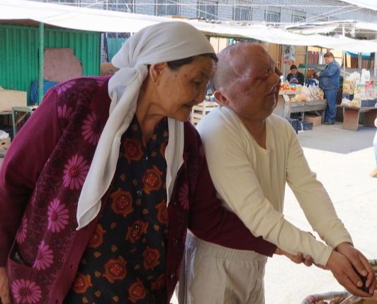 The victims like Berik, seen here after a facial operation, have been left struggling with their lives