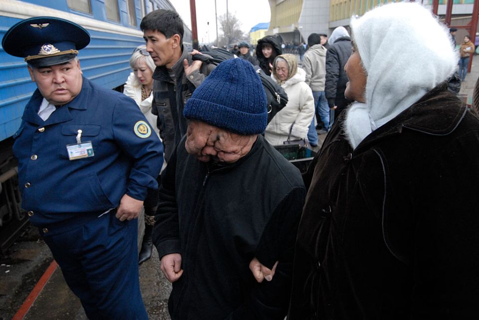 Berik who was born not only blind, but disfigured after years of winds blowing radioactive fallout over his village