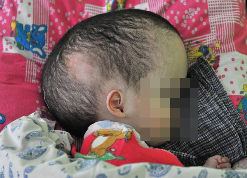 Dina Kadyrova, one year and 9 month-old, sleeps in a orphanage, in Semipalatinsk