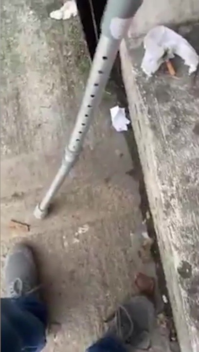 The man appears to use a crutch but has not been named