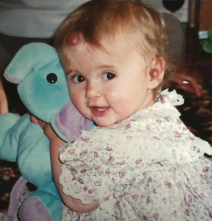 Molly has shared a series of snaps of her birthmark with fans over the years