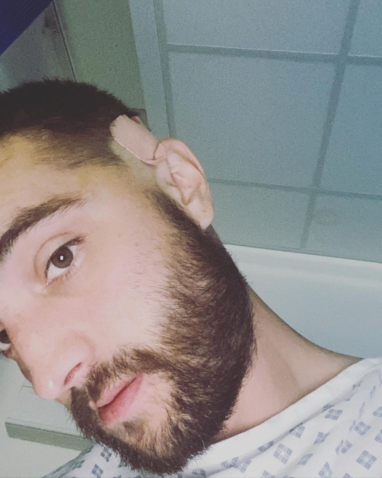 Tom Parker pictured days before his shock brain cancer diagnosis