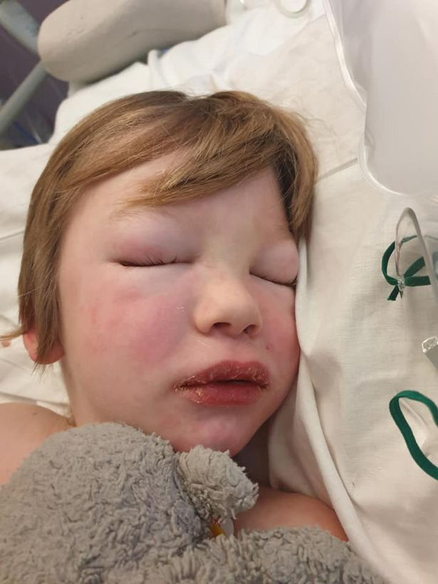 Logan Walsh, seven, was diagnosed with PIMS-TS six weeks after beating Covid-19