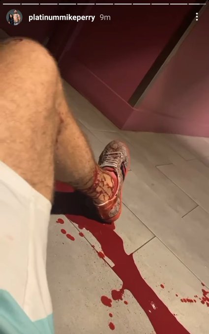 Mike Perry's leg was covered in blood 