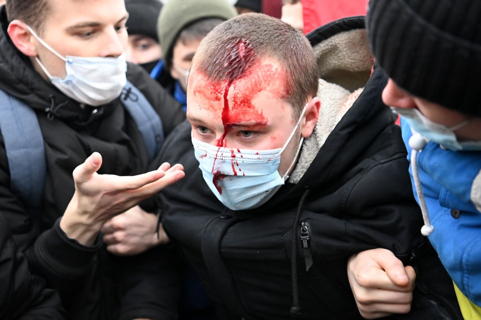 One protester seen with a bloodied head after clashes with police