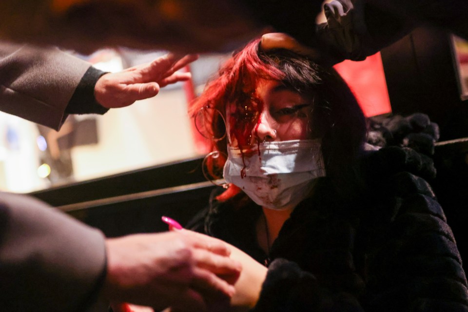 This woman was among more than 30 people injured