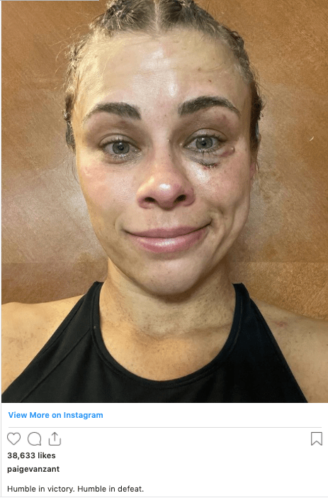 Paige VanZant addresses her BKFC loss online