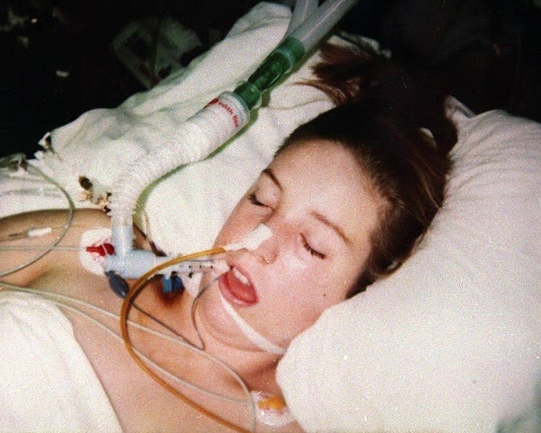 Teenager Leah Betts lying critically ill in the intensive care unit at Broomfield hospital, Essex, after taking a suspected contaminated ecstasy pill at her 18th birthday party in 1995