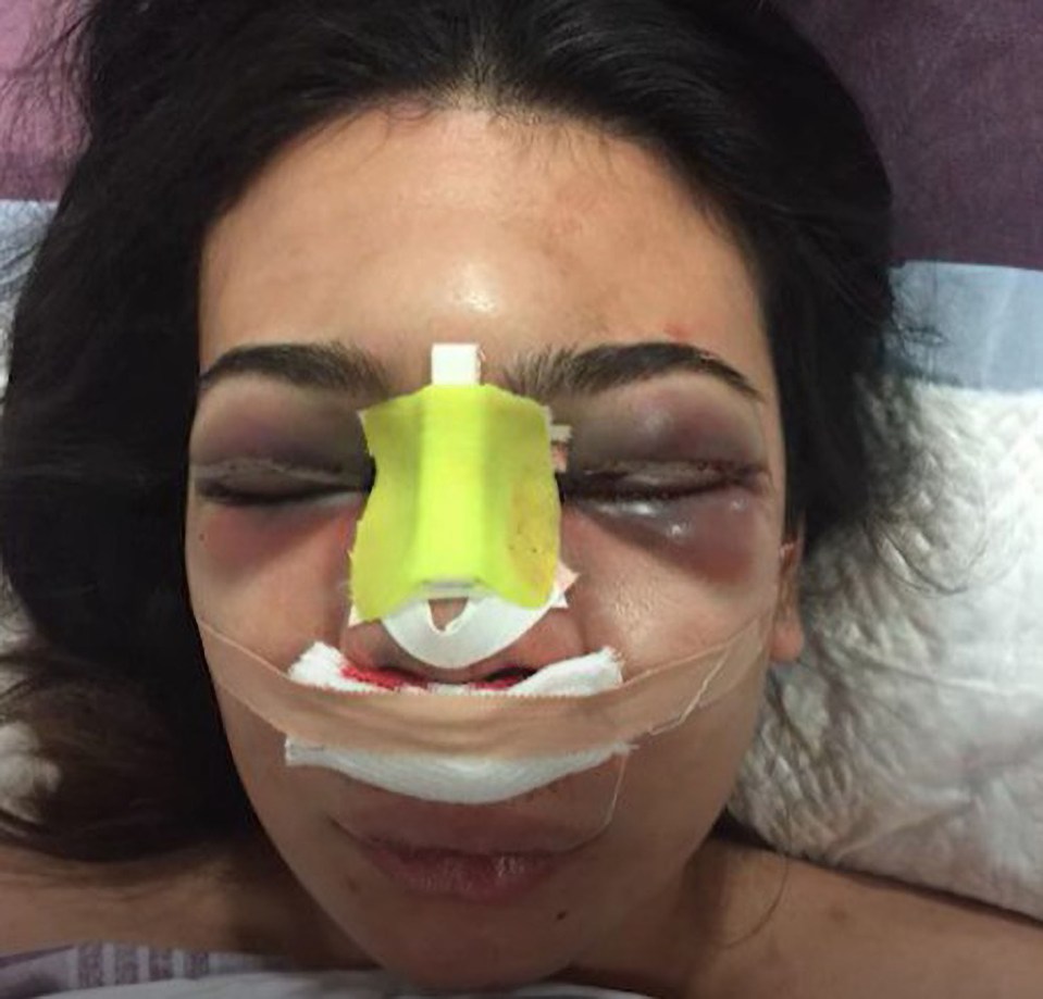 She ended up in a coma after a bungling surgeon punctured her skull by mistake