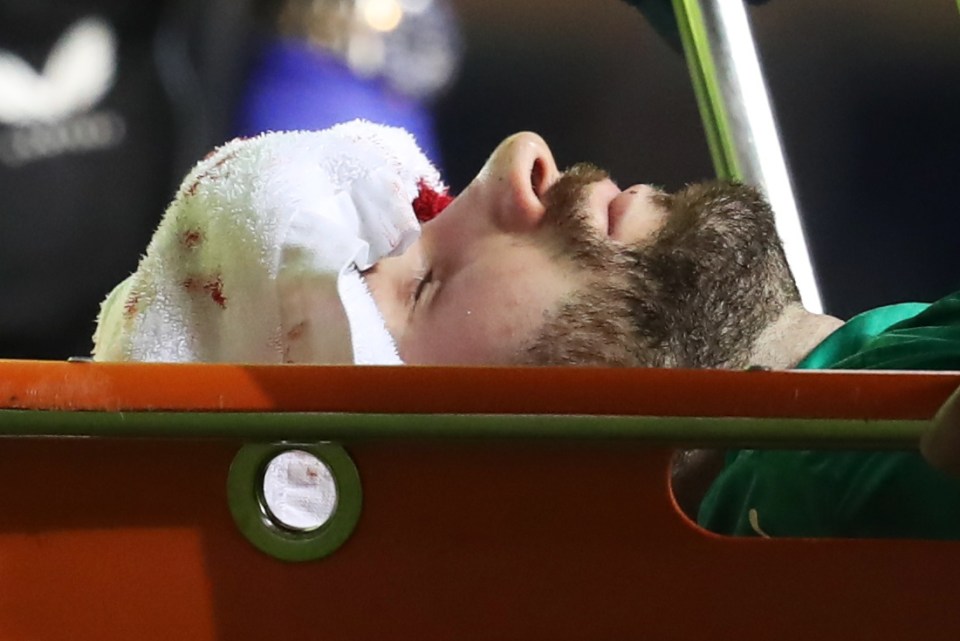 Kolar had to leave the pitch on a stretcher and with a makeshift bandage on his forehead