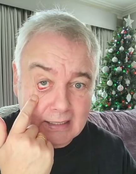 Eamonn revealed he's dealing with 'chronic pain' and struggling to sleep in a message to fans