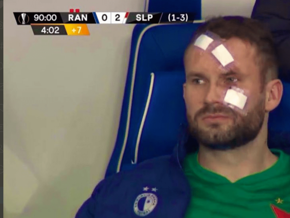 Thankfully the keeper was able to watch the end of the match from the dugout with bandages covering his wounds