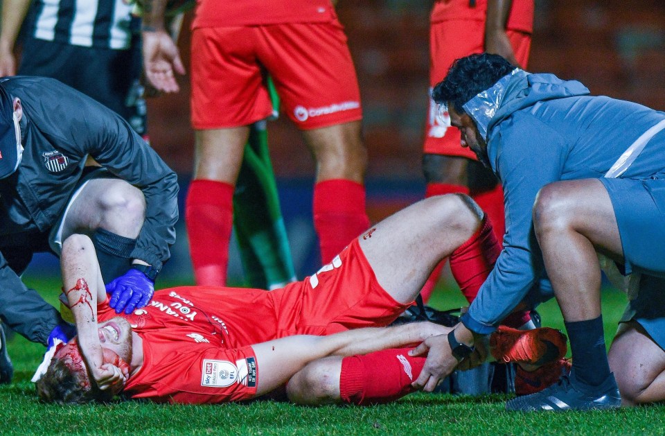 Leyton Orient defender Adam Thompson cut his head and broke his ankle against Grimsby