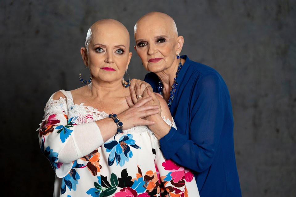 two women with shaved heads are posing for a picture