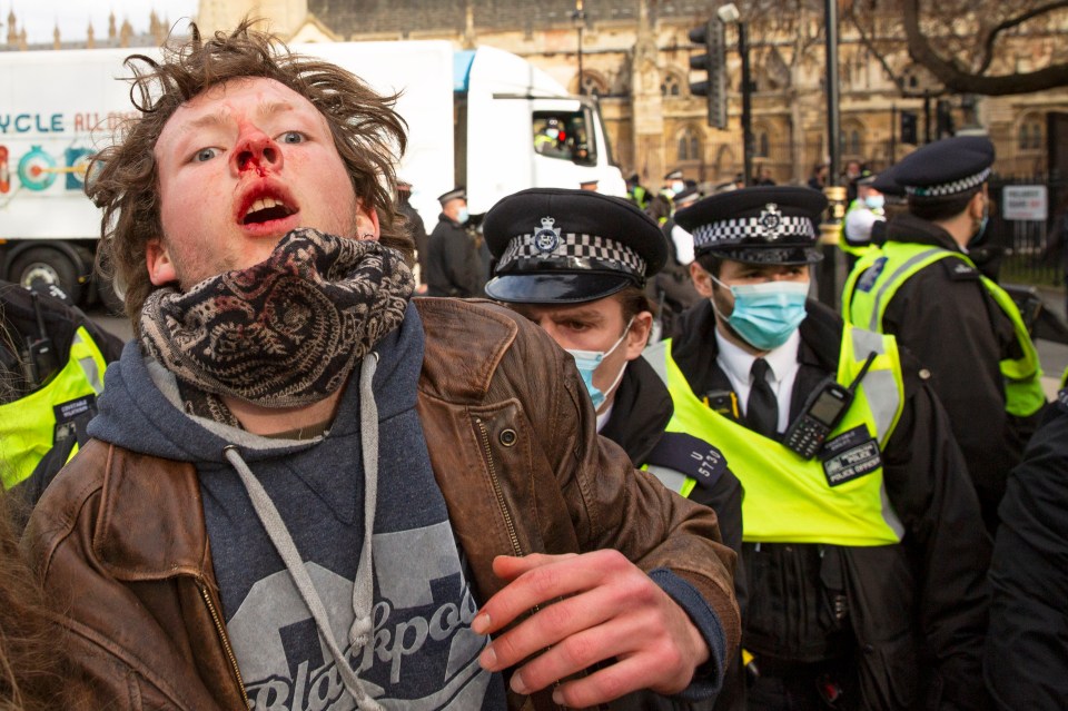 A bloodied man is pushed back by police in Parliament square