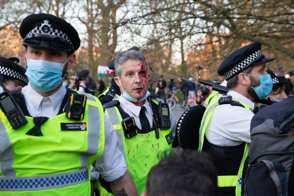 One police officer is pictured with a bloody head